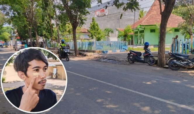 
					PENGEROYOKAN: Pengeroyokan oleh sekelompok pemuda di Jl. Imam Bonjol Kraksaan, membuat Agung Ramadan Putra (31) babak belur. (foto: Ali Ya'lu).